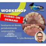 Ferulizacion en dientes periodontales comprometidos